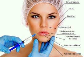 Preenchimento Facial